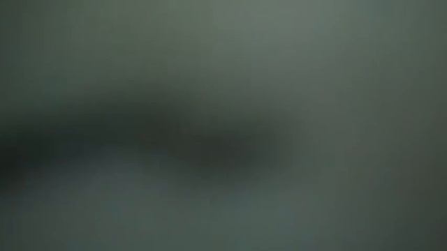 Киста яичника. Лечение Пиявками. смотреть онлайн