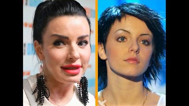 Юлия волкова до и после пластики
