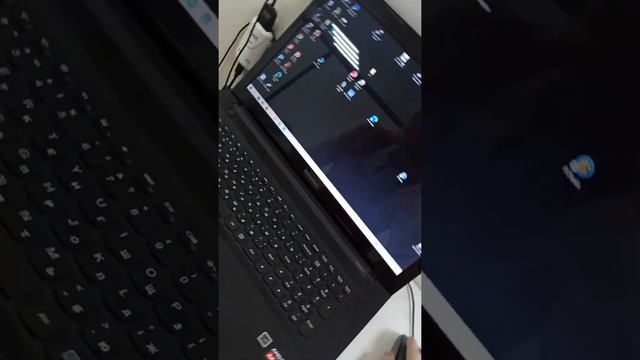 Рентген-сеимки Зубов смотреть онлайн