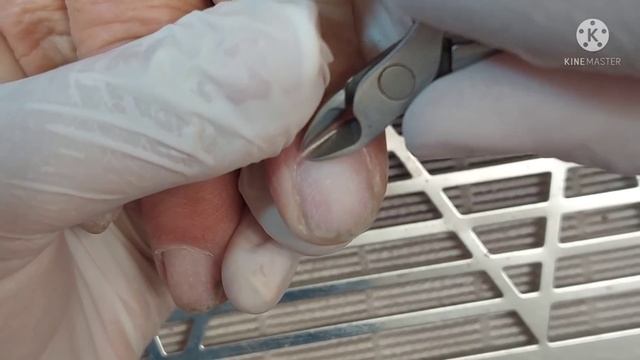 Загоняла иголки под ногти ??Преображение возрастных ручек ? смотреть онлайн