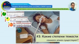 #3: Какие степени тяжести сонного апноэ существуют? | СОАС и СИПАП-терапия