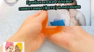 Грибок кожи головы: симптомы (фото) и лечение