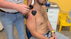 Плечо. Инструментальная мобилизация при помощи вакуумных банок. ИММТ/IASTM. Павел Коломиец.