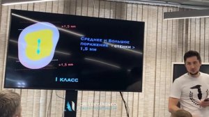 Когда перекрывать бугры при препарировании под накладки.