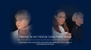 Пластика лица и шеи: интервью пациентки.