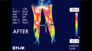 Инфракрасные лучи