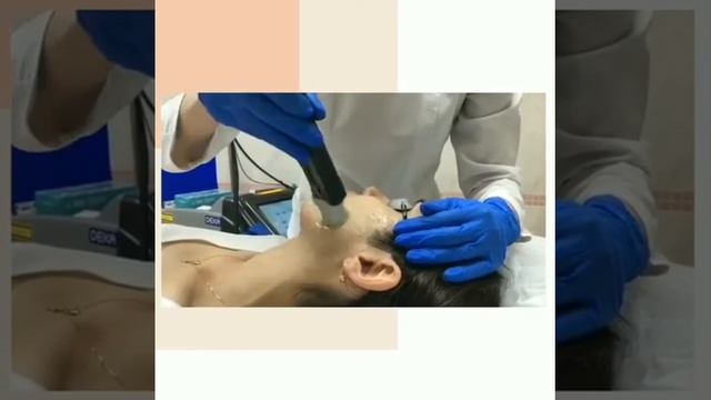 Лазерная эпиляция Moveo смотреть онлайн