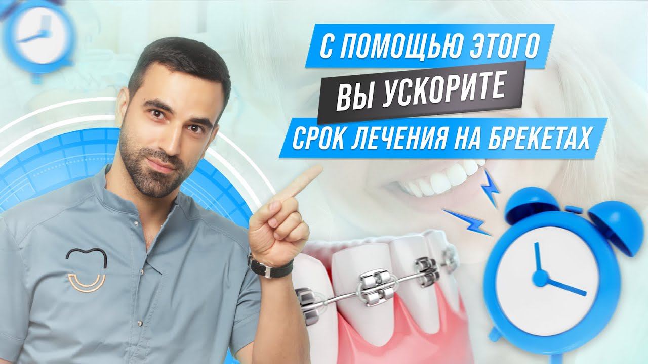 КАК ПОВЛИЯТЬ НА СКОРОСТЬ ЛЕЧЕНИЯ НА БРЕКЕТАХ?  #брекеты #элайнеры