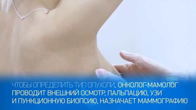 Доброкачественные новообразования молочной железы