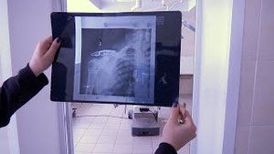 Осторожно – гололёд! Травматолог спешит на помощь. 13.01.2022г.