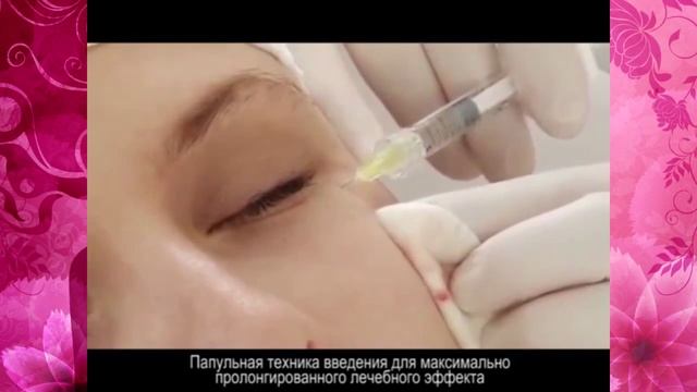 Инъекции гиалуроновой кислоты для омоложения кожи Томилова А А