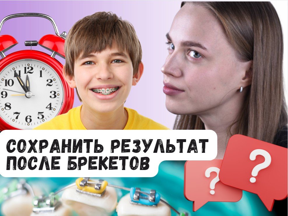 Как сохранить результат после брекетов