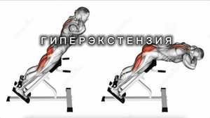 Гиперэкстензия
