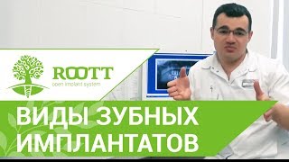 ❓ Виды имплантации зубов. Кратко о методах установки имплантов