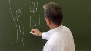 Виды ампутаций конечностей