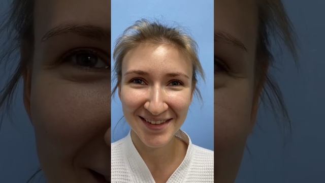 Ринопластика ? Пластика носа смотреть онлайн