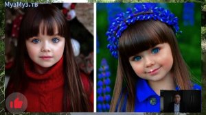 Как сейчас выглядит девочка-кукла, которую 7 лет назад называли самой красивой в мире.