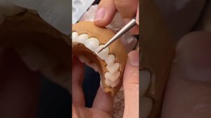 Glaze dental technician зубной техник керамика ceramics Noritake technik dentystyczny 1 牙科技师