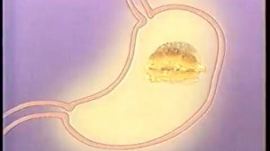 Реклама Мотилиум 1999