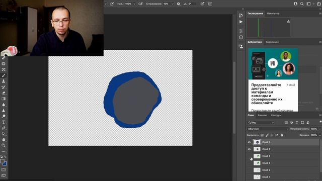 эндо-доступы в верхних молярах смотреть онлайн