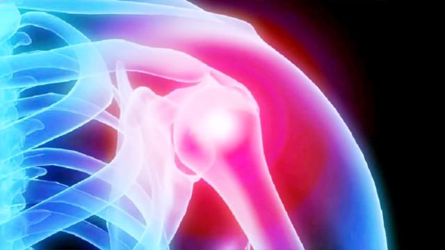 Reklam för Voltaren gel смотреть онлайн