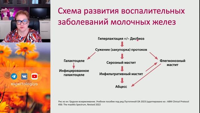 Послеродовой мастит: новые (старые) подходы l Пустотина О. А. смотреть онлайн