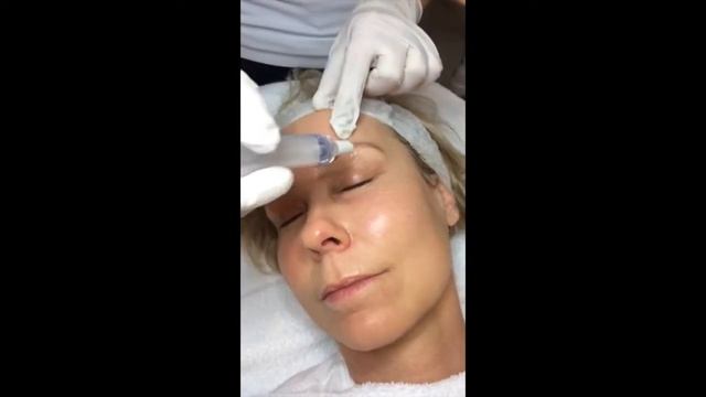 ENERPEEL E&L TEBISKIN смотреть онлайн