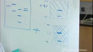 Electrophoresis: How to Read Results