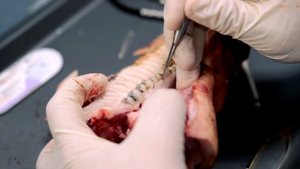 Пластика мягких тканей десны после имплантации - обучение, доктор Руслан Хатит