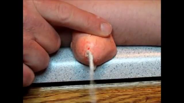 Самое смешное:видали когда-НИБУДЬ такой прыщик! смотреть онлайн