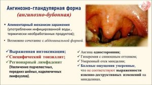 PROСТО О СЛОЖНОМ Туляремия, ч.2, Инфекционные болезни №9