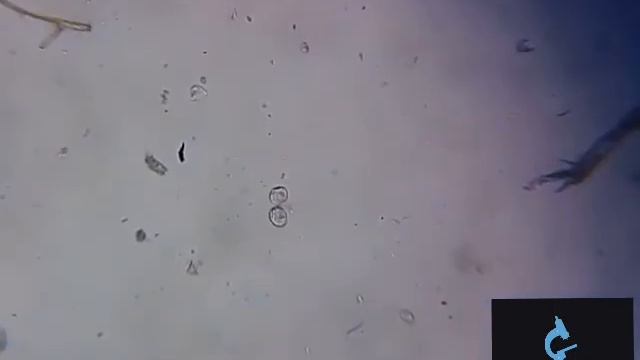 Деление инфузории под микроскопом. Митоз инфузорий. смотреть онлайн