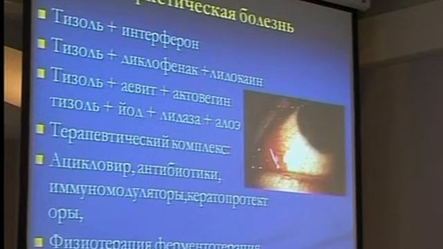 Тизоль в офтальмологии смотреть онлайн
