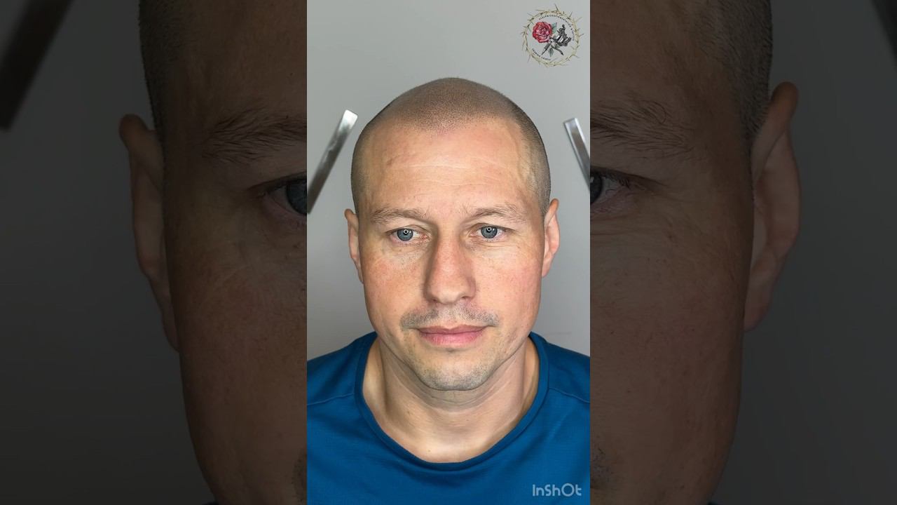 Воссоздали прическу! Тату волос, трихопигментация лучше чем пересадка Smp Scalp micropigmentation