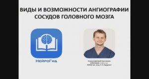 Виды и возможности ангиографии сосудов головного мозга