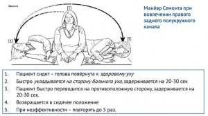 Манёвр Семонта