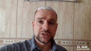 Как нужно мыть голову после пересадки волос