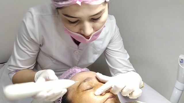 #Лазерная ручка для удаления #Пигментных пятен #Жеровике #Бородавок
