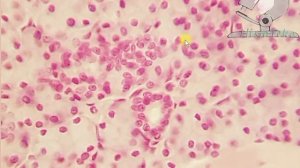 ЛИСТОВИДНЫЕ сосочки языка