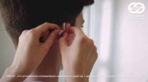 Инструкция по применению ушных корректоров Арилис