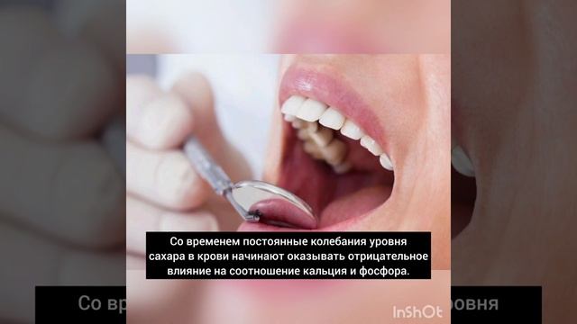 сахар разрушает зубы? опосредованное влияние сахара на зубы!