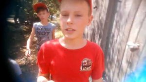 Перелом ноги