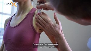 Тейпирование дельтовидной мышцы