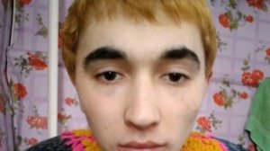 Парень принимал гормон прогинову 2 мг