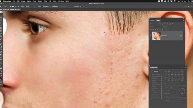 Photoshop Tutorial for Beginners - Photoshop how to remove pimples easy смотреть онлайн