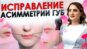 КАК УБРАТЬ АСИММЕТРИЮ И УВЕЛИЧИТЬ ГУБЫ | Контурная пластика губ