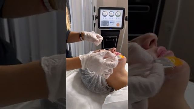 Смас лифтинг смотреть онлайн