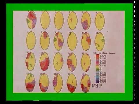 Документальный фильм Бумеранг. Метод Бронникова
