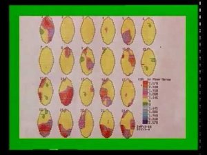 Документальный фильм Бумеранг. Метод Бронникова