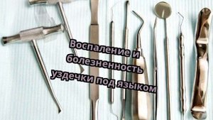 Воспаление и болезненность уздечки под языком